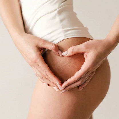 Rhenuks / Crema para Estrias